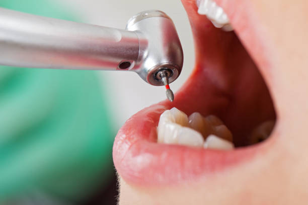 Emergency Dental Services for Seniors